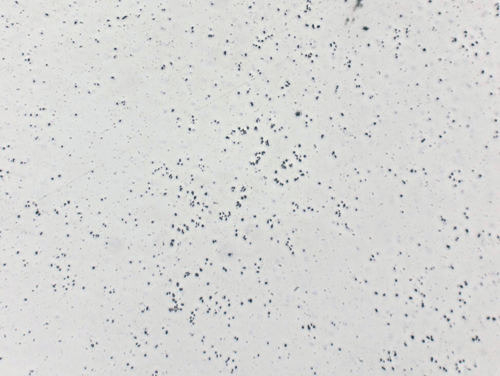 Aluminum
