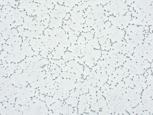 Aluminum